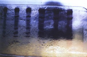 Zymogram of date palm "Black Bousthami" variety